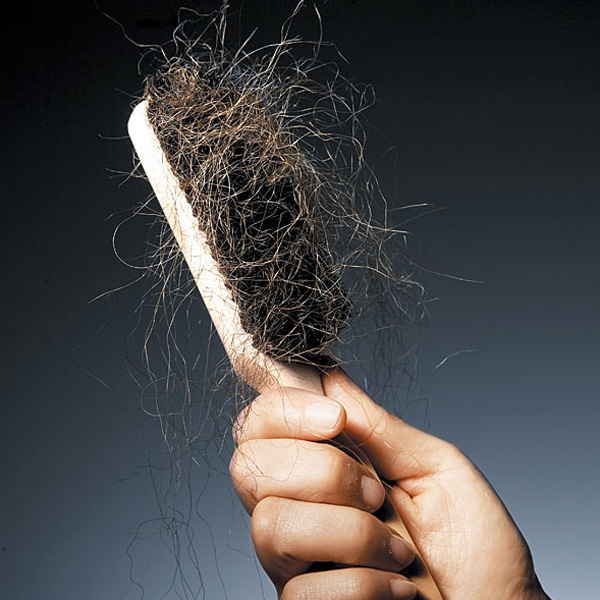 alternative causes of hair loss