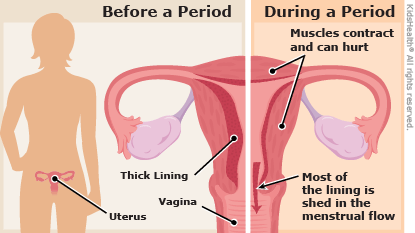menstrual-cramps