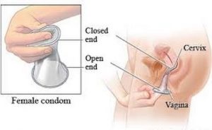 female-condom5