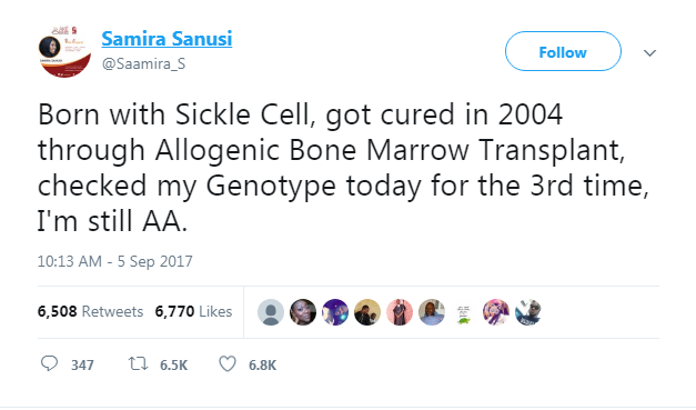 SS Genotype