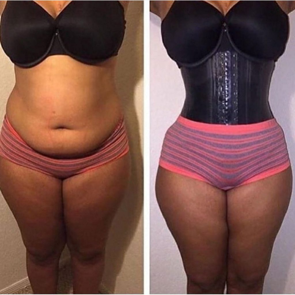 Waist trainer before and after online organs