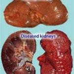 kidney