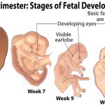 first-trimester