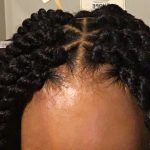 too tight braids
