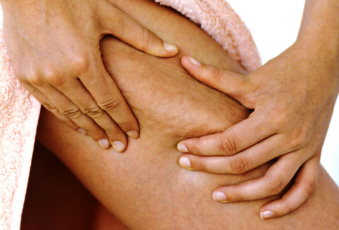 facts about cellulite