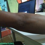 4 Natural Ways To Get Rid Of Dark Elbows And Knees dark elbows