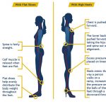 High-Heels-Effects-On-Spine-Body-Hips-and-Knees