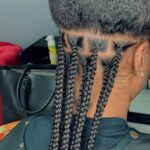 alopecia box braids