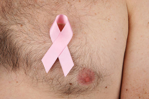 BREAST CANCER IN MEN: Important but left behind.