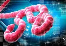 ebola viral disease