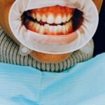 pexels-anna-shvets-3845855-2