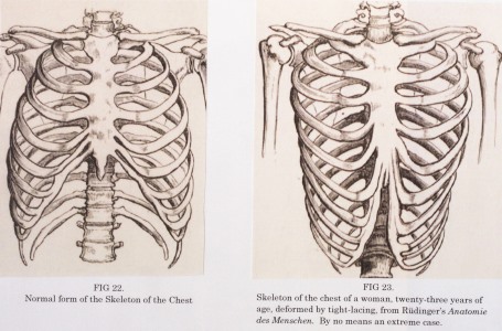 Corset diet: Extreme weight loss trend sees women constricting their ribs  for 12 hours a day