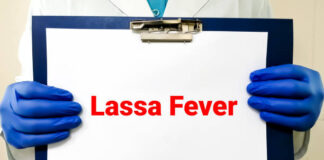 Lassa Fever Nigeria