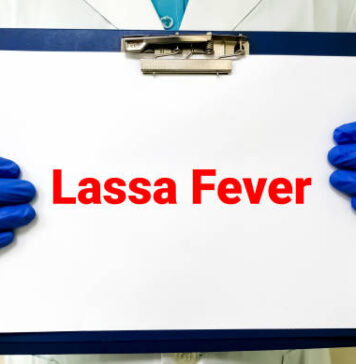 Lassa Fever Nigeria