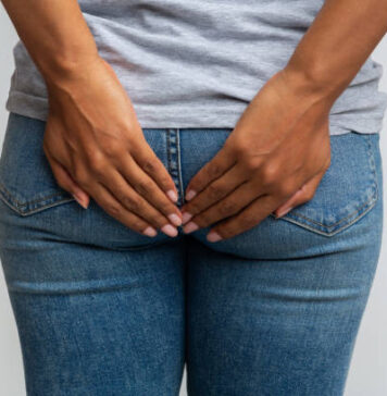 hemorrhoids piles