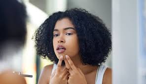 A woman bursting a pimple on her face depicting hormonal acne 