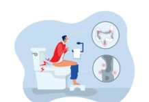 Hemorrhoids