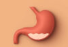 Peptic ulcer