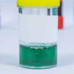 Green,And,Clear,Of,Urine,Specimen,For,Urine,Examination,In