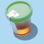 Urine Sample