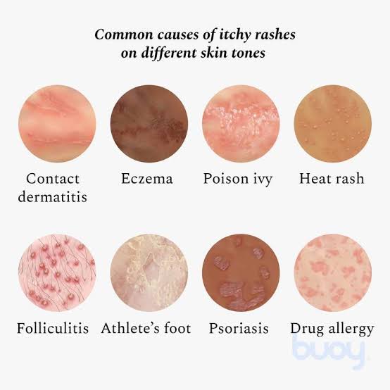 A picture showing different skin reactions
