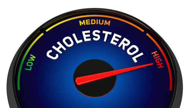 4+ signs of high cholesterol