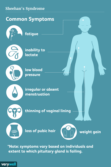 Sheehan's syndrome symptoms
