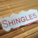 shingles