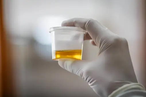 Do you know what your urine colour means? Quiz.