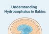 “My Baby’s Head Is Getting Bigger!” – Understanding Hydrocephalus